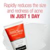 Neutrogena Rapid Clear Stubborn Acne Face Wash