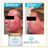 Era Organics Rosacea Redness Relief Cream