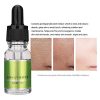 10ml Pore Therapy Serum - Essence for Smooth, Hydrated Skin, Pores Shrinking and Oil Control