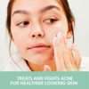 Aveeno Clear Complexion Foaming Oil-Free Facial Cleanser