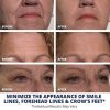 Experience Age-Defying Magic with Plexaderm Fast Reduction Serum - Single Use Pods for Quick Under-Eye Baggage and Wrinkle Treatment