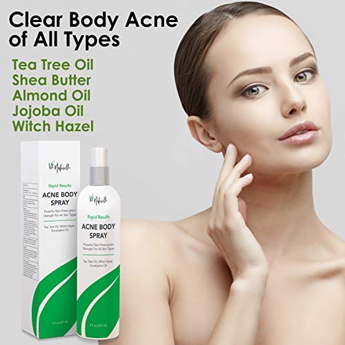 Body and Face Acne Spray Treatment with Benzoyl Peroxide