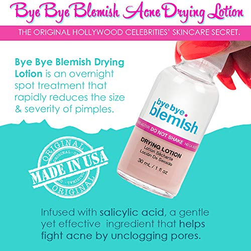 Bye Bye Blemish Acne Drying Lotion