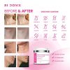Si Doux Neck Firming Cream – Crepey Skin Treatment