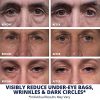 Experience Age-Defying Magic with Plexaderm Fast Reduction Serum - Single Use Pods for Quick Under-Eye Baggage and Wrinkle Treatment