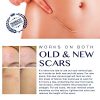 Scar Remover Gel for Scars from C-Section
