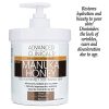 Superior Clinicals Manuka Honey Cream - Spa Size 16oz for Exceptionally Dry, Aging Skin on Face, Neck, Hands, and Body