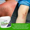 TriDerma Intense Fast Healing Cream