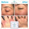 Period Organics Extra Strength 16-in-1 Skin Rash Cream - Your Solution to Healthy, Itch-Free Skin