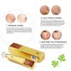 Advanced Scar and Stretch Mark Removal Gel