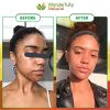 African Black Soap: Unleash Your Natural Glow with Confidence! 🌿✨