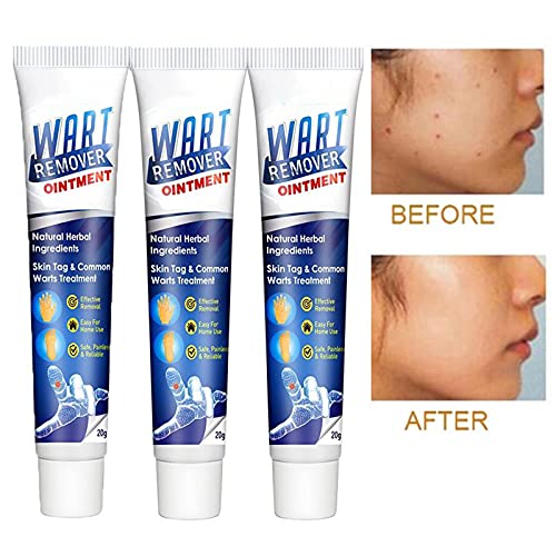 2Pcs Wart Remover Ointment for Effective and Gentle Skin Tag Removal
