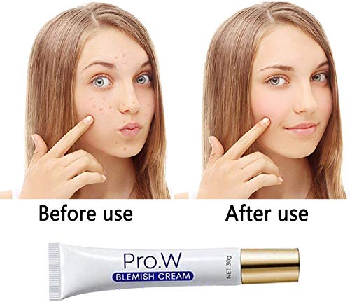 Pro.W Blemish Cream Spots Removal Treatment