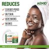 Acne Treatment Natural Cream - Made in USA