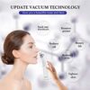 Blackhead Remover Vacuum and Acne Extracting USB Rechargeable