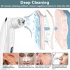 Acne, Grease, and Comedone Remover Vacuum with Camera