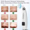 Blackhead Remover Vacuum with 5 Adjustable Suction Levels