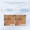 Glytone Enhance Brightening Complex with 12% Azelaic Acid
