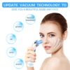 Blackhead Remover Vacuumfacial pore cleaner that utilizes electrical suction