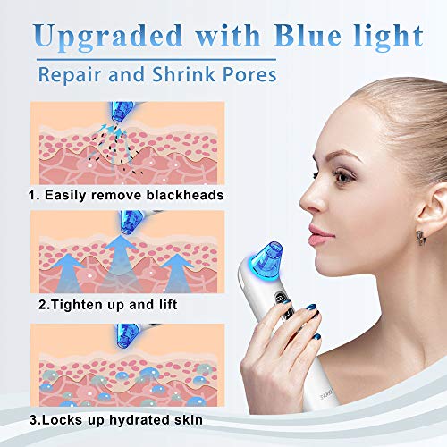 Blackhead Remover Pore Vacuum Extractor Cleansing Technology