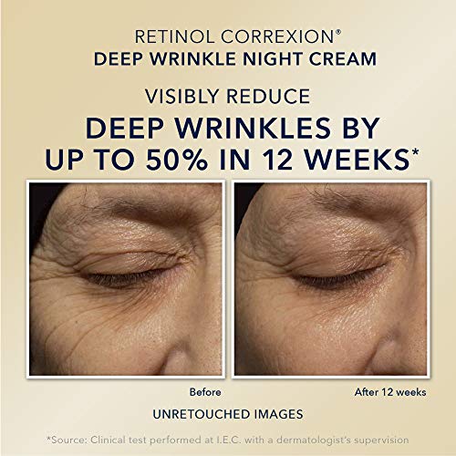 Roc Retinol Value Set Duo, Deep Wrinkle Night Face Cream