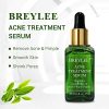 BREYLEE Tea Tree Clear Skin Serum – Powerful Acne Treatment with Camellia Sinensis Extract