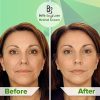 Timeless Beauty: Retinol Moisturizer - Your Anti-Aging Secret! ⏳✨