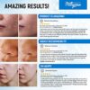Glycolic Acid Exfoliating Pads – Face, Body Resurfacing Peel