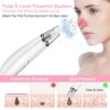 Blackhead Remover Vacuum – For Clear, Radiant Skin Anytime! 🌟