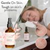 Retinol Serum 2.5% Vitamin A for Face