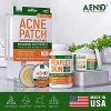 Cystic Acne Treatment and Acne Scar Remover