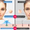 Blackhead Remover Pore Vacuum Extractor Cleansing Technology