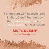 Neutrogena SkinClearing Mineral Acne