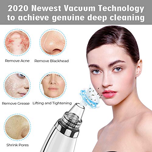Blackhead Remover Vacuum with 5 Adjustable Suction Levels
