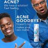 Daily Care Deep Pores Acne Face Wash Hydrating