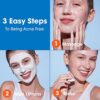 Acne Free Sulfur Mask 1.7 oz Acne Treatment for Clearing Acne