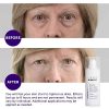 Youthful Skin with Beverly Hills Instant Facelift and Eye Serum - Image 4