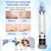 Rechargeable Blackhead Remover Vacuum for Whitehead and Blackheads Removal