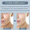 Lift & Firm at Home – Uaike Facial Body Skin Tightening Machine