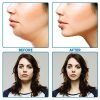 V Shaped Slimming Face Mask Double Chin Reducer V Line