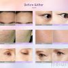 2 in 1 Microcurrent Skin Rejuvenation Facial Care Device
