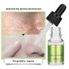 10ml Pore Therapy Serum - Essence for Smooth, Hydrated Skin, Pores Shrinking and Oil Control