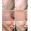 Hyaluronic Acid Moisturizer Face Cream