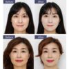Unisex Face Slimmer Lifting Eliminate Wrinkle