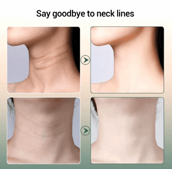 2Multi-Function Neck and Face Lifting Device Multi-Function Neck and Face Lifting Device – Sonic Vibration & Light Therapy for Anti-Aging